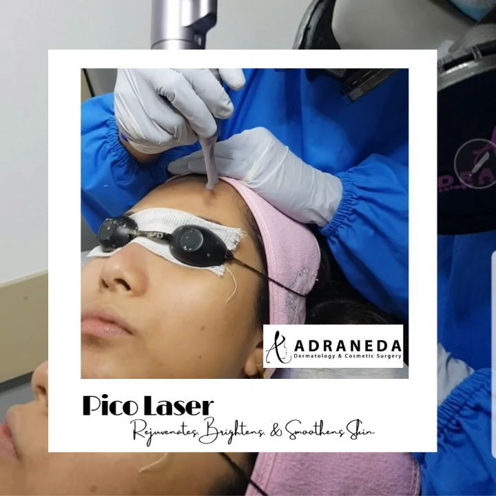 PICO LASER...Rejuvenates, Brightens and Smoothens...