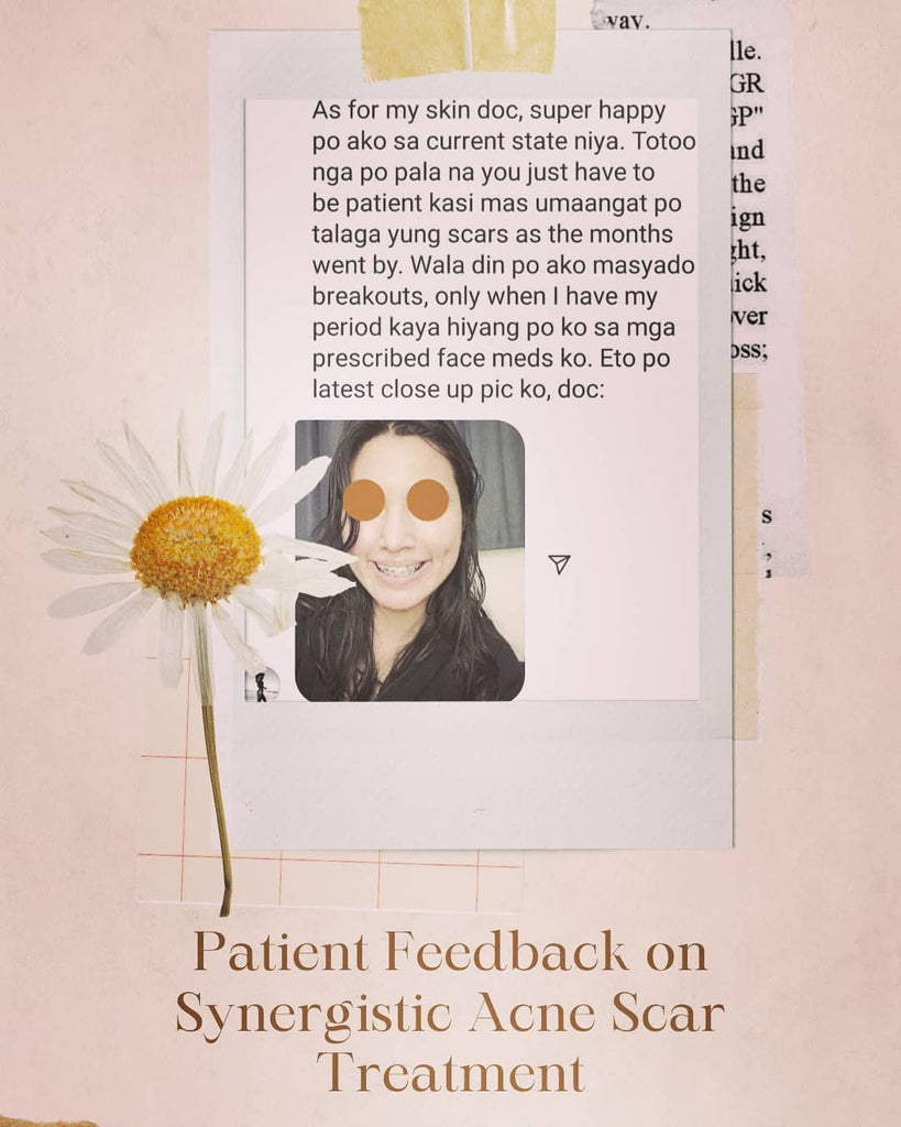 Patient Feedback on Synergistic Acne...