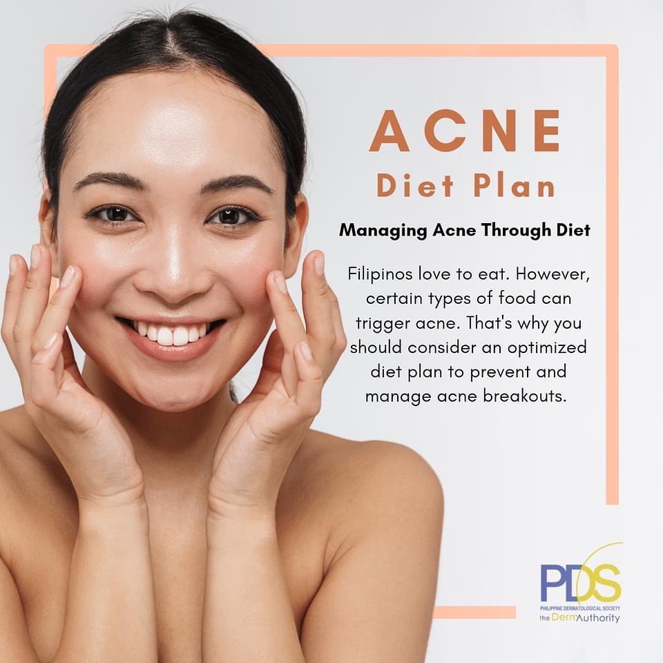 Here are some tips t