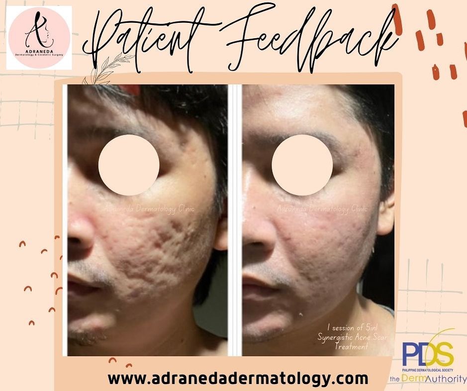 Patient feedback aft