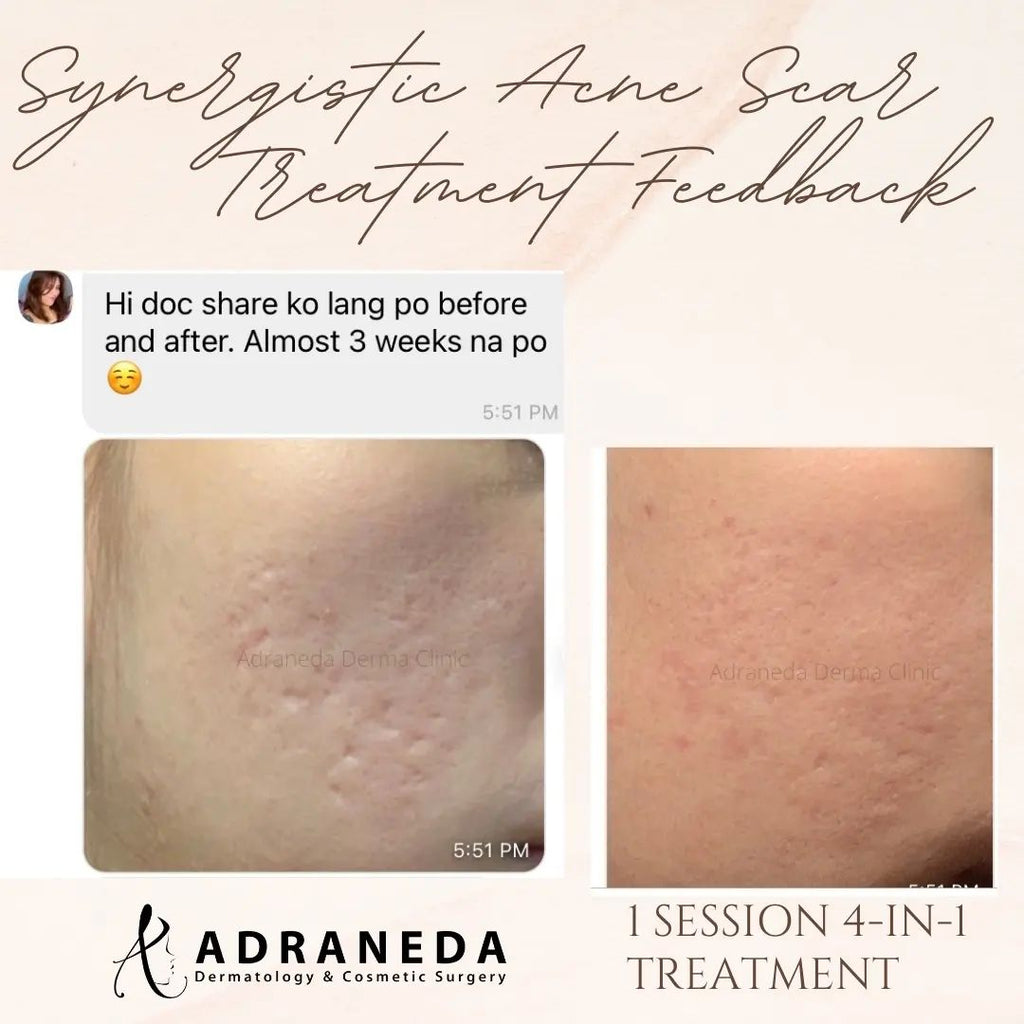 Patient Feedback Aft