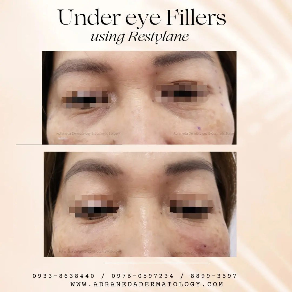 Do you always look t