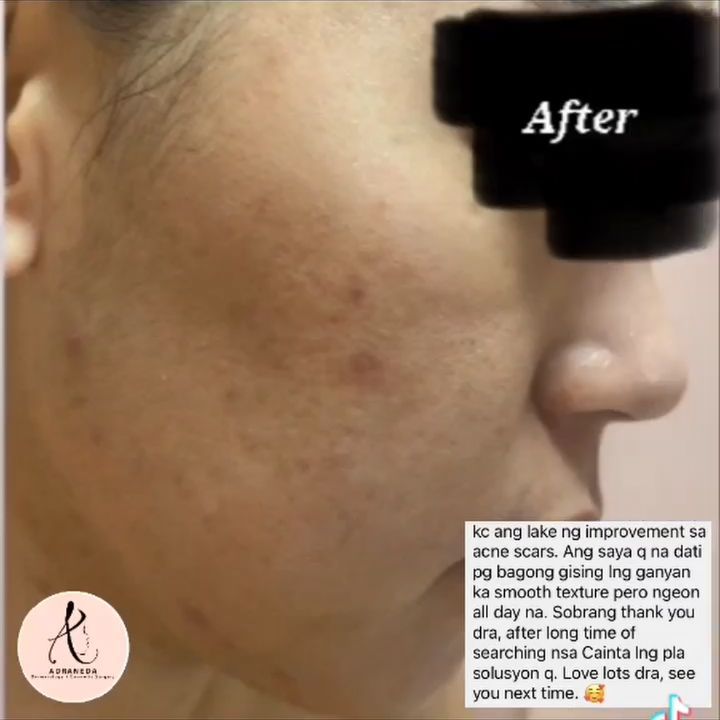 Patient feedback aft