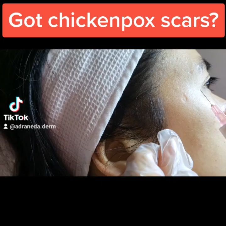 Instantly lift chick