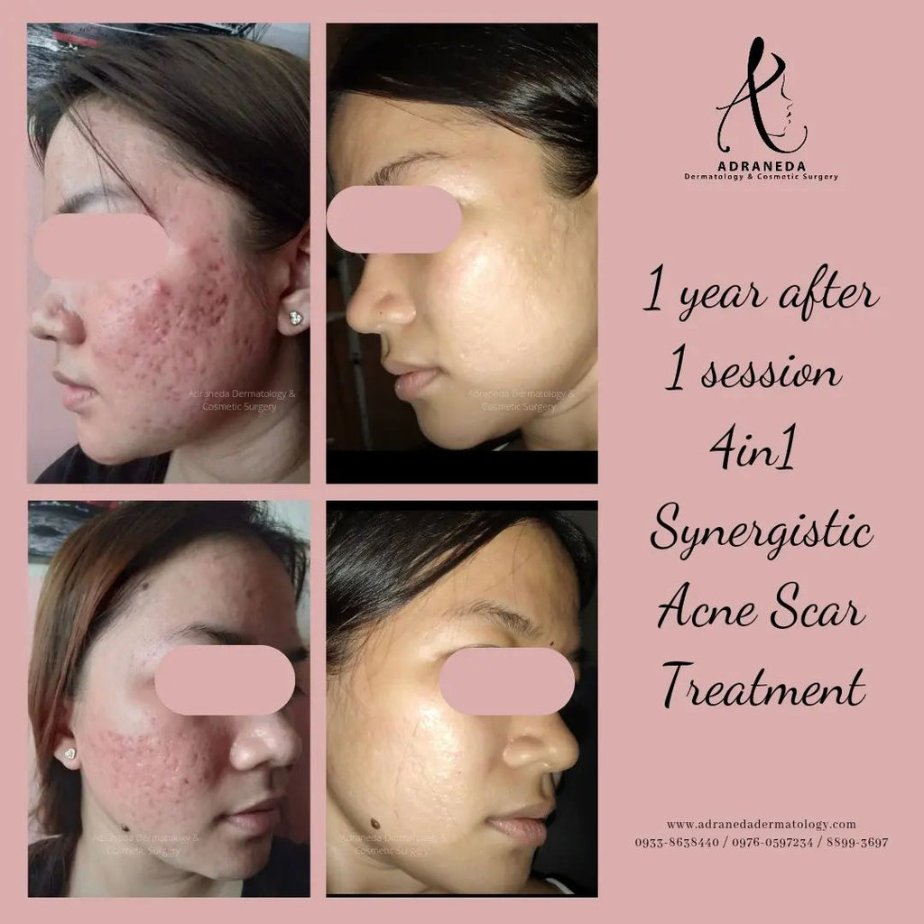 Time heals all wound