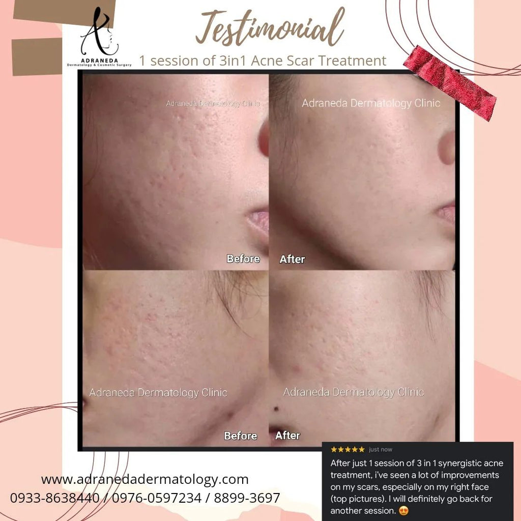 Patient feedback aft