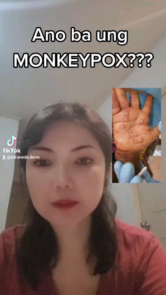 What is Monkeypox? P