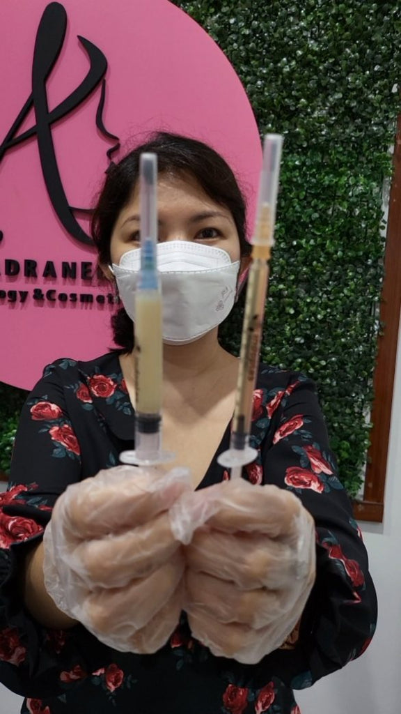 Patients always ask,