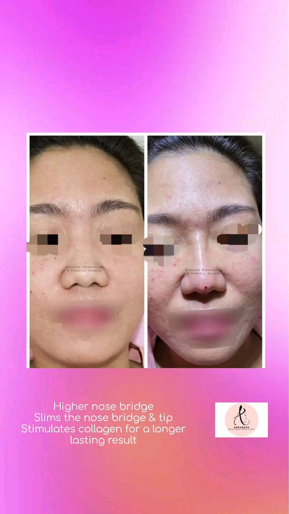 The dream nose you'v