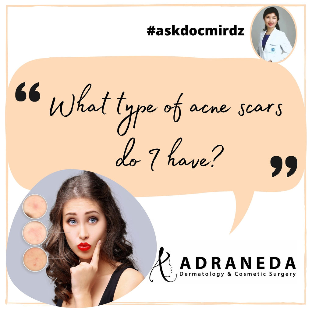"What type of acne scars do I have?"