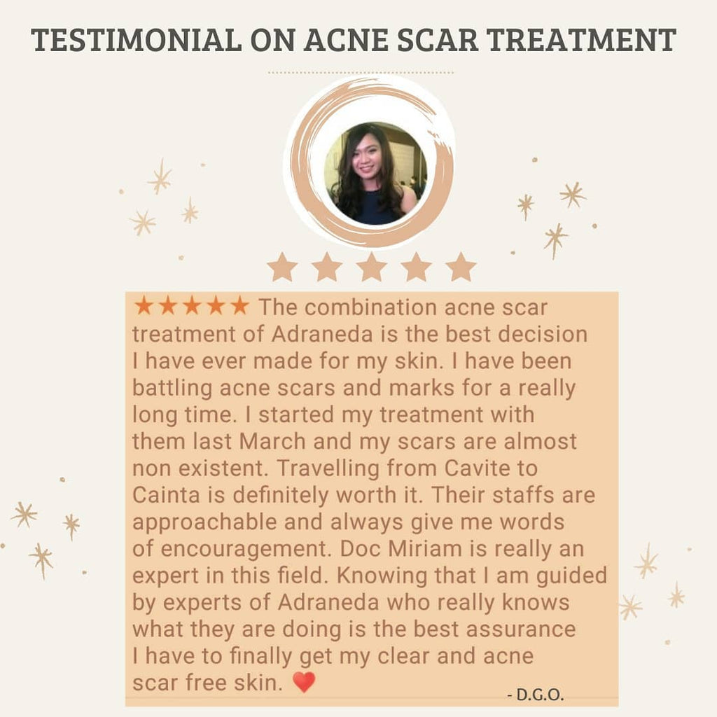 Testimonial on Acne Scar Treatment<br...