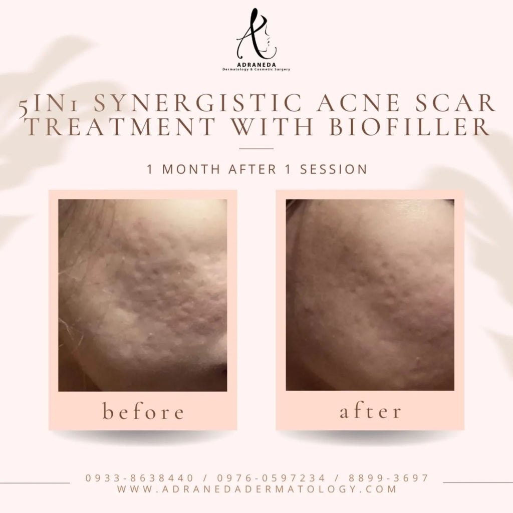 Do you want to impro