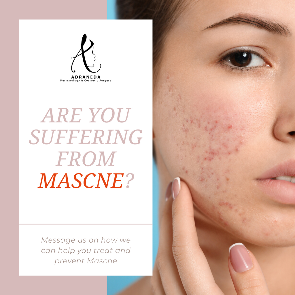 Are you suffering from MASCNE (Acne due to mask)?